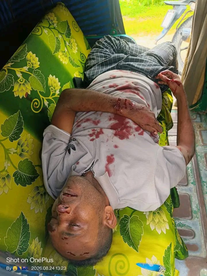 তামাবিল মহাসড়কে ট্রাকের ধাক্কায় মোটরসাইকেল আরোহী নিহত